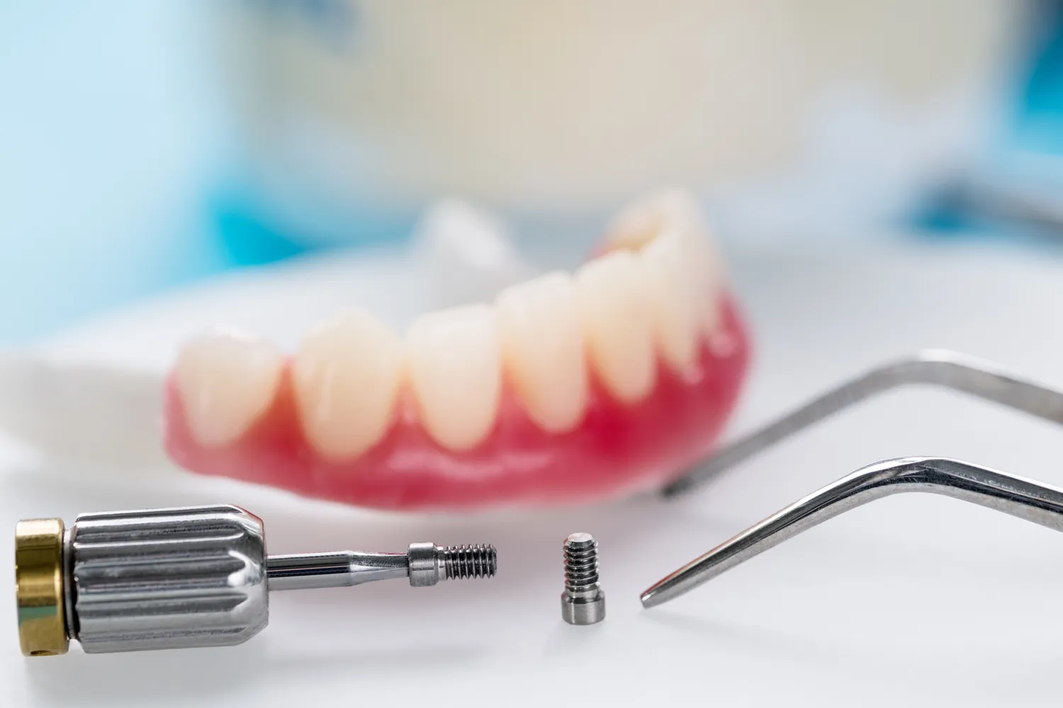 Cena implantu zęba Warszawa