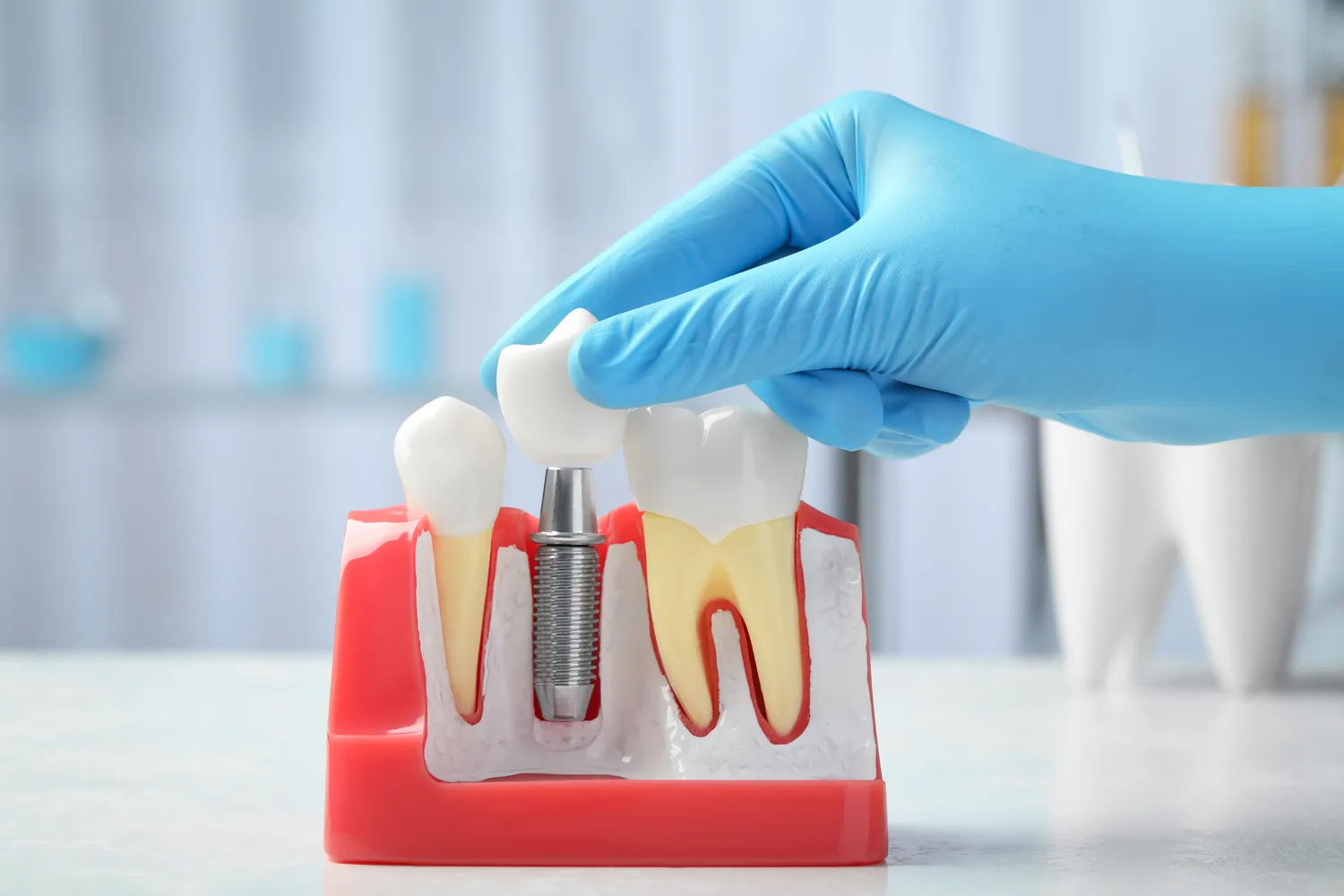 Endodoncja Szczecin